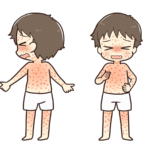 子供を「はしか」から守る！原因と予防の真実。マスク・手洗い・うがいの効果と雑踏対策